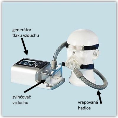 PAP přístroj se skládá z generátoru tlaku vzduchu, zvlhčovače, vrapované hadice a masky